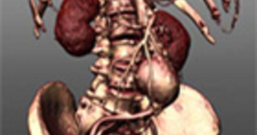 VoluMedic™ для LightWave