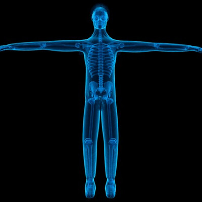 X-ray